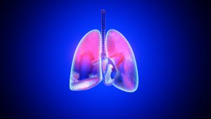 3D illustration of inflamed and infected Lungs